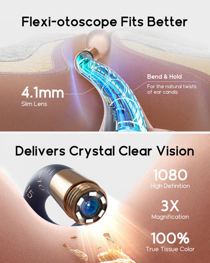 Bebird EarSight Plus I35R – HD Visual Ear Cleaner with Camera & Wireless Tweezers